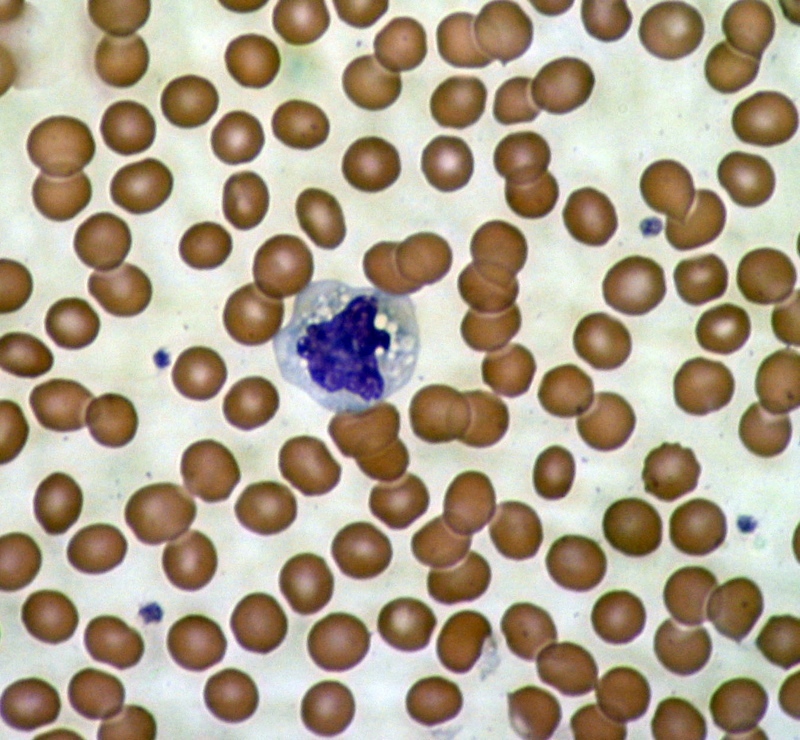 Een microscopisch beeld van bloedcellen - rode bloedcellen omringen een cel van het immuunsysteem.  