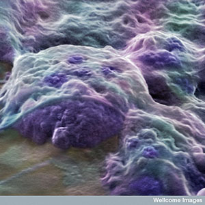Deze embryonale stamcellen, die afkomstig zijn van een menselijk embryo, kunnen in elk celtype veranderen. Maar ze zijn moeilijk te verkrijgen en kunnen niet direct worden gebruikt om HD te behandelen.