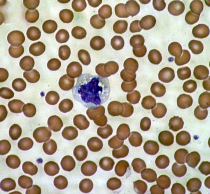 Een microscopisch beeld van bloedcellen - rode bloedcellen omringen een cel van het immuunsysteem.