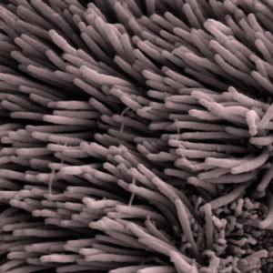 Cilia zijn kleine, haarachtige uitsteeksels op onze cellen. Verschillende tags zorgen ervoor dat huntingtine en cilia op verschillende manieren met elkaar omgaan.