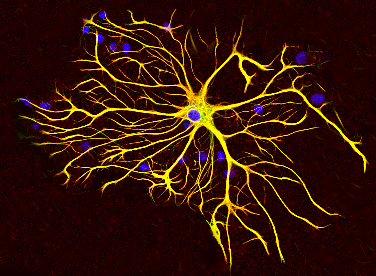 Astrocyten ondersteunen de gezondheid van neuronen door chemicaliƫn en voedingsstoffen in de hersenen te regelen.
