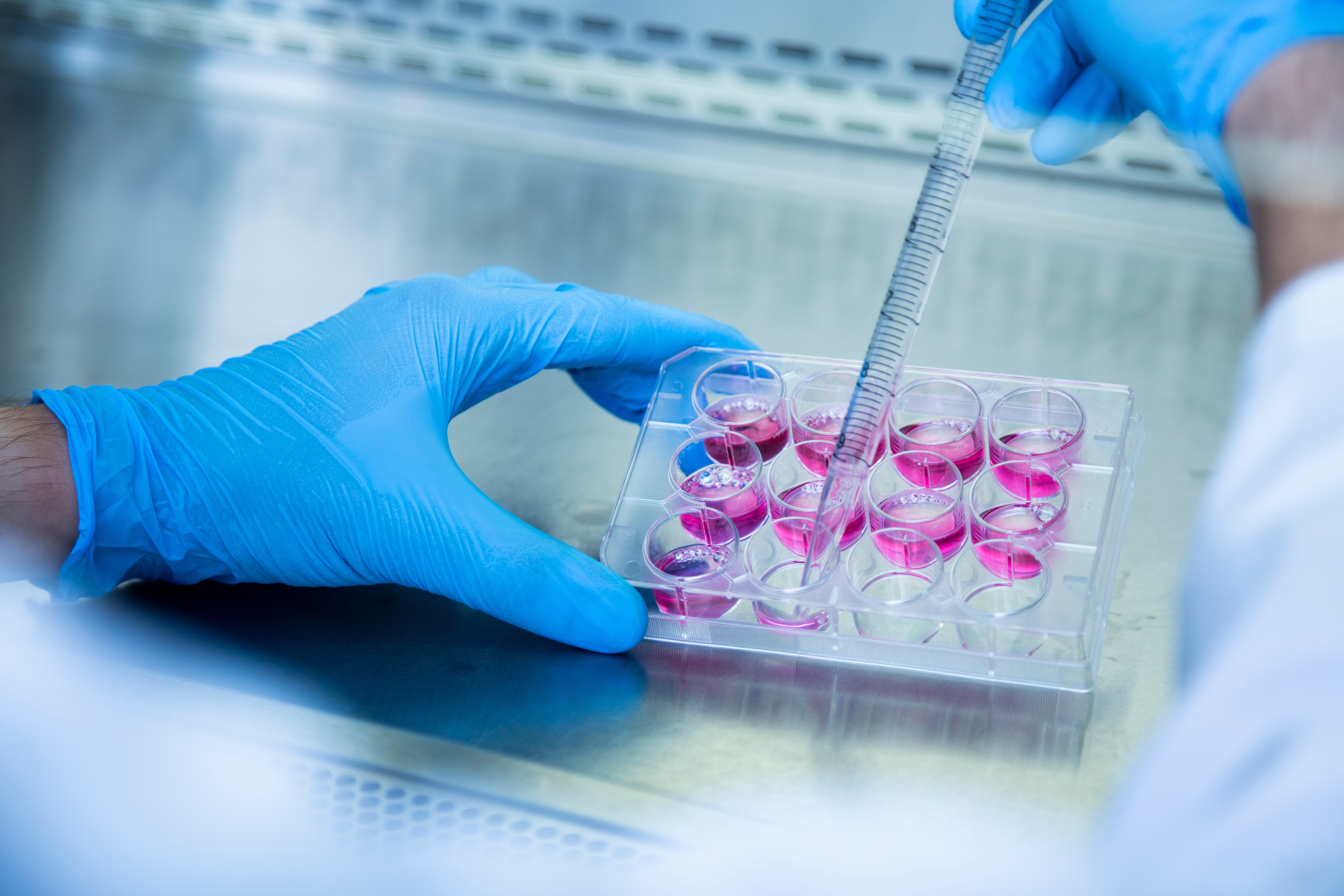 Het kweken van cellen in een 'schaaltje' stelt onderzoekers in staat om in een laboratorium de effecten van verschillende soorten stress op hersencellen te bestuderen.