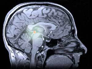 De pijnappelklier ligt diep in de hersenen en is bij de mens de belangrijkste bron van het hormoon melatonine   