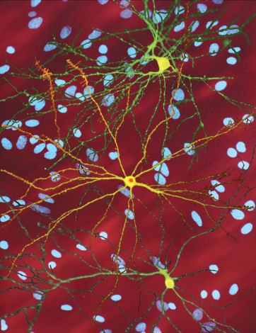 Afbeelding van neuronen in kweek uit het laboratorium van Finkbeiner. De groene en gele cellen zijn ‘gelabeld’ zodat ze oplichten en de vorm van de cellen laten zien.  