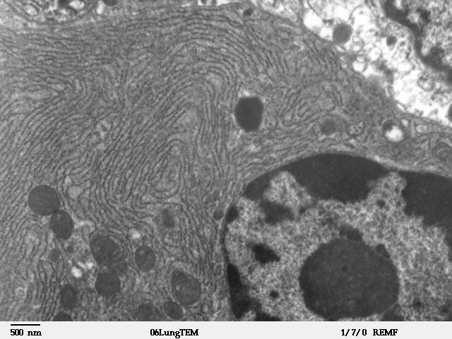 De golvende lijnen in dit plaatje zijn het 'endoplasmic reticulum' van een cel - een opslagplaatsen voor calcium. Hierop zitten de ryanodine receptoren.   