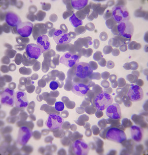 Witte bloedcellen hebben de taak het lichaam te beschermen tegen binnendringende ziektekiemen.  