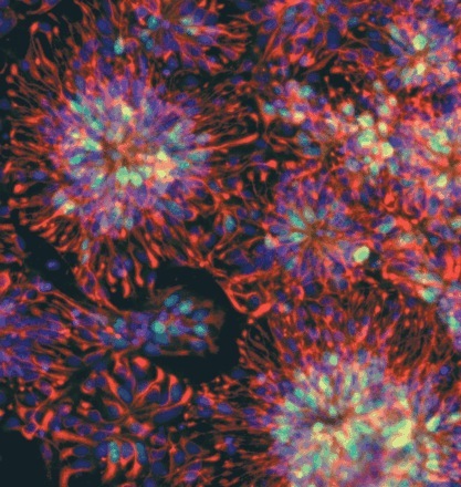 Menselijke embryonale stamcellen groeien in een kweekschaaltje  