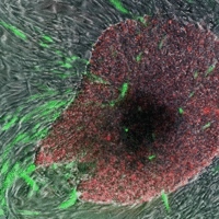 ‘Geïnduceerde pluripotente stamcellen’ in het groen en rood groeien uit de omliggende huidcellen  