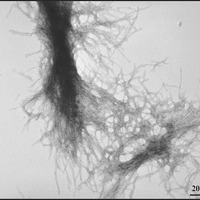 Een foto van gezuiverd mutant huntingtine eiwitaggregaten gevormd in het lab. Deze klonters van eiwitten zijn ook gevonden in de hersencellen van mensen met de ZvH.  