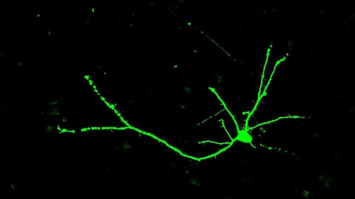 Zenuwcellen hebben de vorm van bomen - met een cellichaam dat veel takken aan de bovenkant van de zenuwcel bevat, een lange stam en een vertakt 'wortel'-systeem aan de onderkant van de cel.  