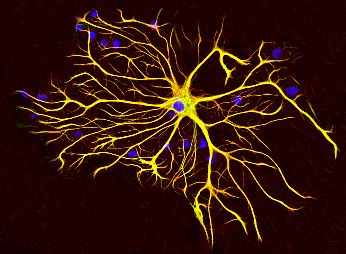 Astrocyten ondersteunen de gezondheid van neuronen door chemicaliën en voedingsstoffen in de hersenen te regelen.  