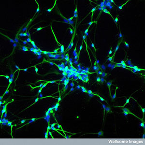 Stamcellen kunnen gebruikt worden om neuronen te kweken in het lab. Deze neuronen zijn zeer krachtige hulpmiddelen om ziektes zoals de ZvH te bestuderen.  